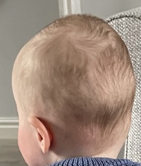 Colour of baby’s hair
