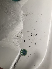 Black gunk inside Oral-B electric toothbrush head?