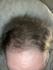 Cancer Support Thread 96: It’s nearly Christmas - get the sprouts on.