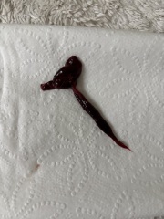 Possible miscarriage? 6 weeks 4 days