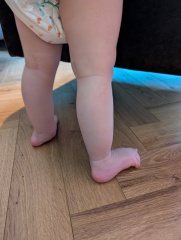 Will my 2 year old ever walk?