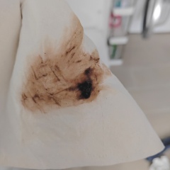 8 weeks - blood when wiping WARNING: PHOTO