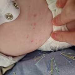 Does anyone know what this rash is?