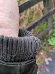 Contact Dermatitis? Please help!