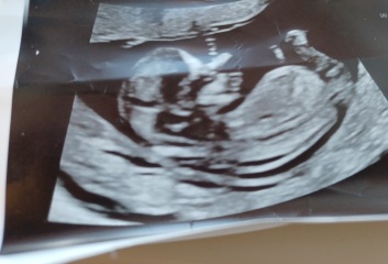 12+2 days any guesses? Skull/nub theory