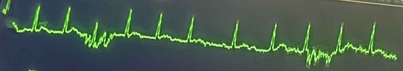 Could anyone help please? Worried about this!