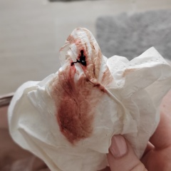 8 weeks - blood when wiping WARNING: PHOTO