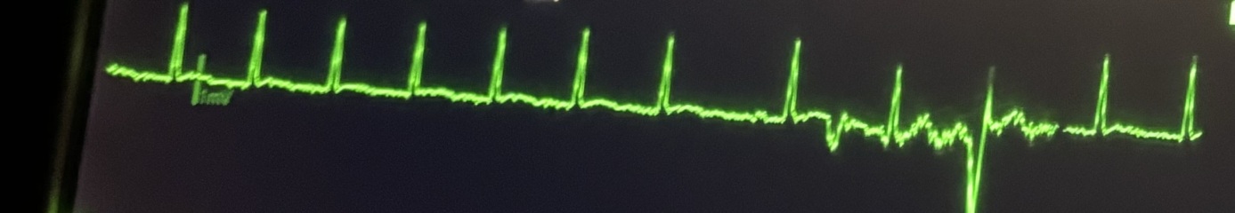 Could anyone help please? Worried about this!