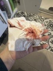 10DPO ?spotting/implantation (images)