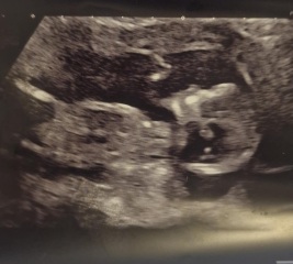 Nub theory 13 weeks then 20 weeks