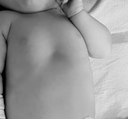 Little dip in chest