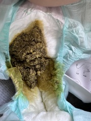 Baby.. Poo- Pictures included.