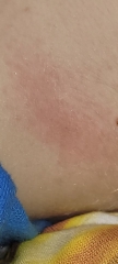 What's this on DS's neck?