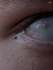 What is this in my DD eye? Please advice?