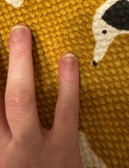 My nails, before and after, advice?