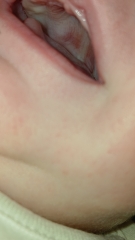 Baby teething 9 weeks old