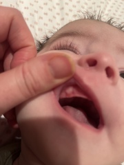 Is this a tooth coming through?! 2 month old