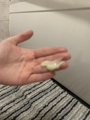 TMI pics! Am i losing my mucus plug already?