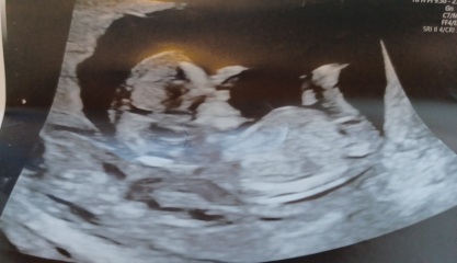 12+2 days any guesses? Skull/nub theory