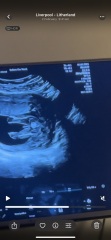 Would you say this is a boy,