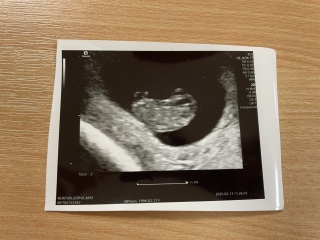 9 week scan reassurance?