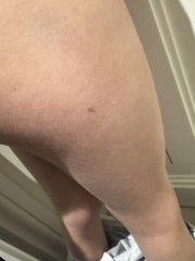 Would you worry over this?