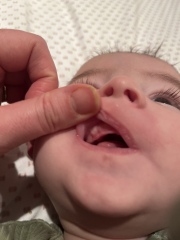 Is this a tooth coming through?! 2 month old