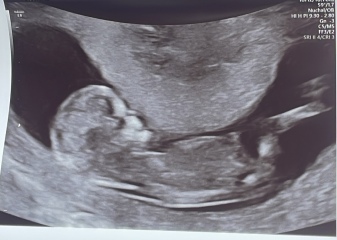 Any gender guesses