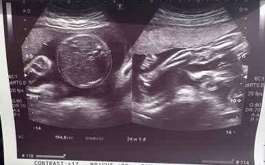 Gender guess