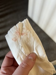 *Graphic Image Warning* Period or implantation edited by MNHQ