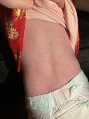 MMR After Injections