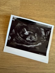 Boy or girl?!