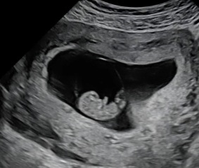 Due in September - over 40 :)