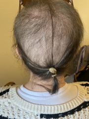 Cancer Support Thread 96: It’s nearly Christmas - get the sprouts on.