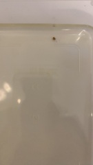 Is this a kidney stone? Picture of urine and suspected stone included.