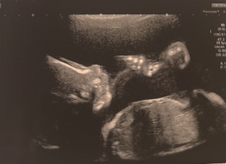 Gender Scan