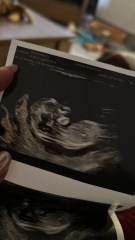 Nub and skull Theory/gender guesses