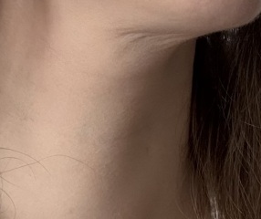 Sagging neck already, at 37?!