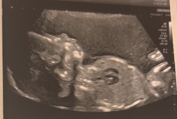 Gender Scan