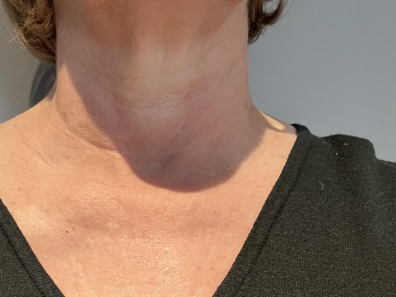 Neck/Throat Cream?