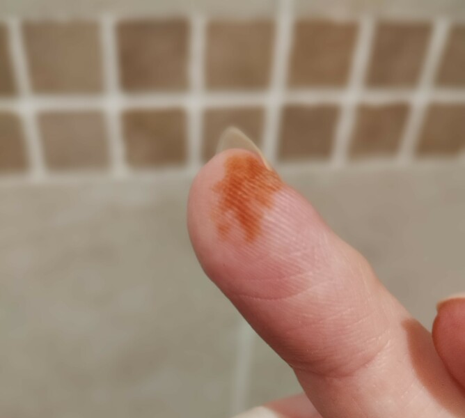 Orange staining Finger