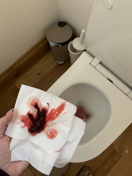 Update: is this a miscarriage?