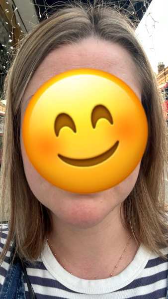 Any hair dressers around? Can anything be done about these money pieces?