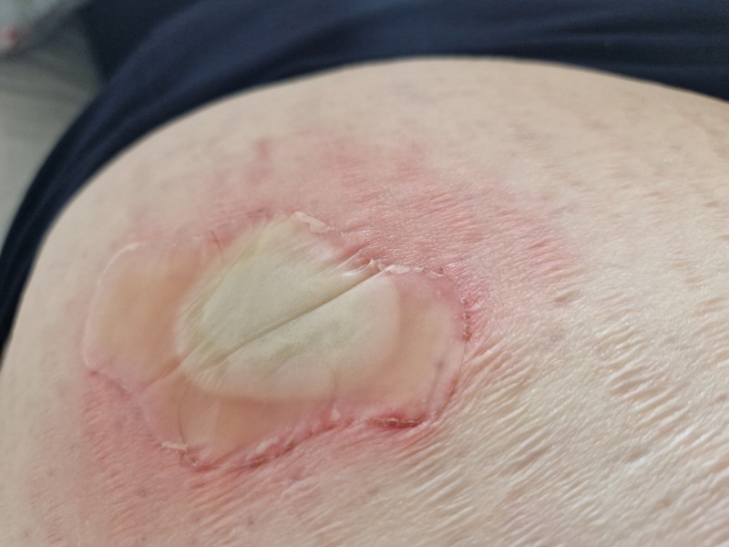 Random raw skin thing - ideas?