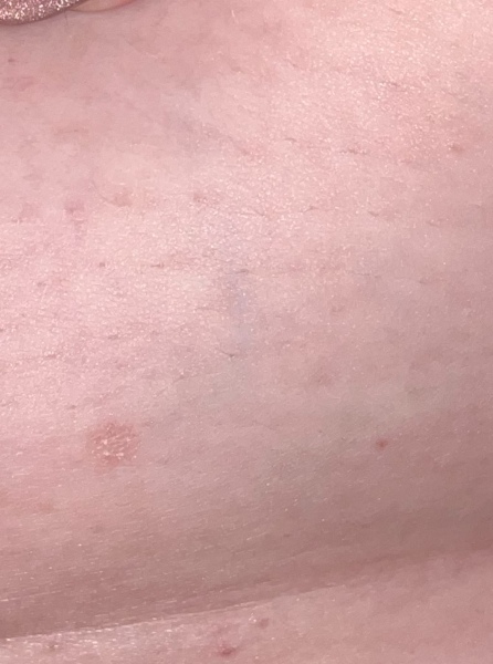 Is this melanoma?? Handhold needed