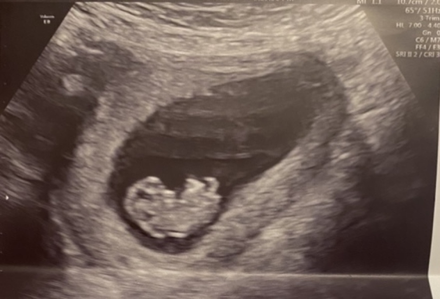 Boy or Girl?