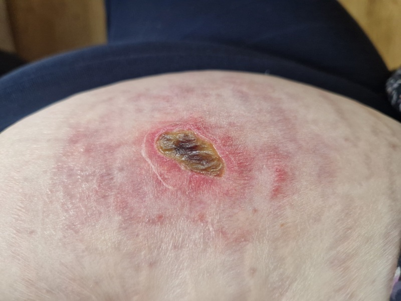 Random raw skin thing - ideas?