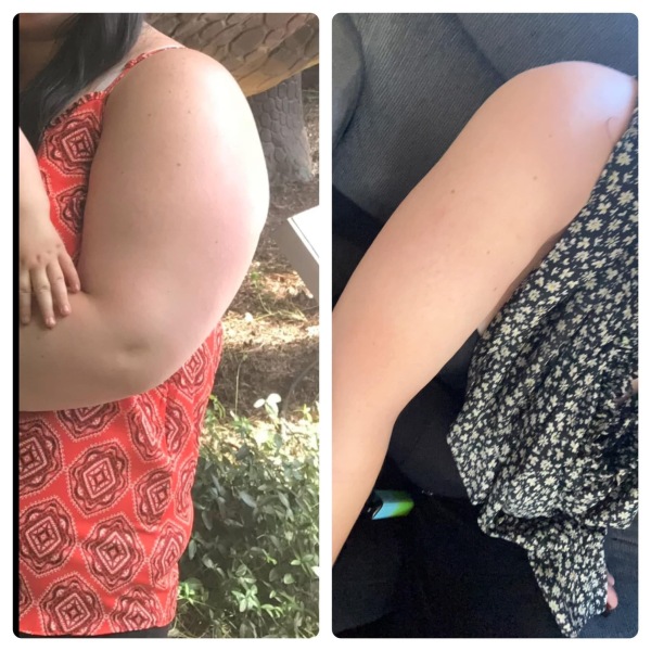 March 2025 starters thread 2