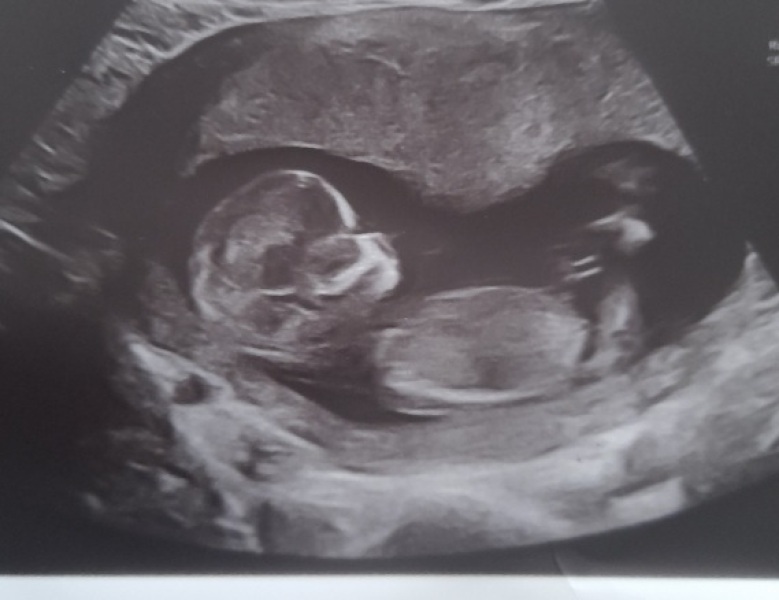 Guessing gender