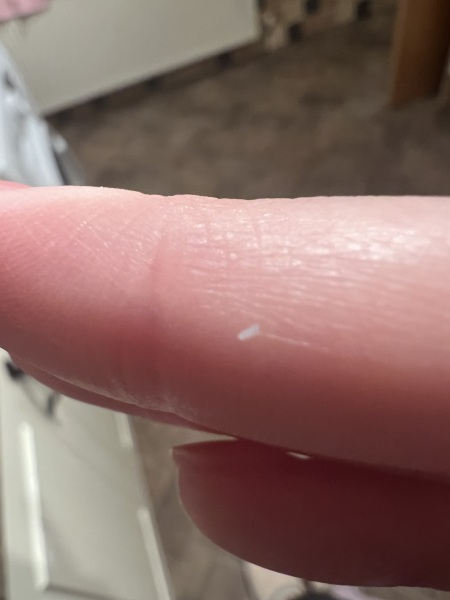 What are these?